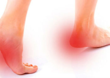 Cuatro consejos para prevenir la fascitis plantar