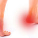 Cuatro consejos para prevenir la fascitis plantar