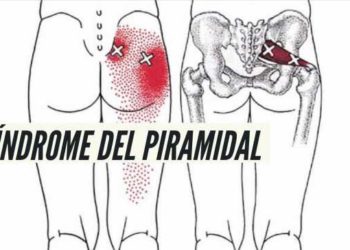 Estira y evita sobrecargas para prevenir lesiones del músculo piramidal