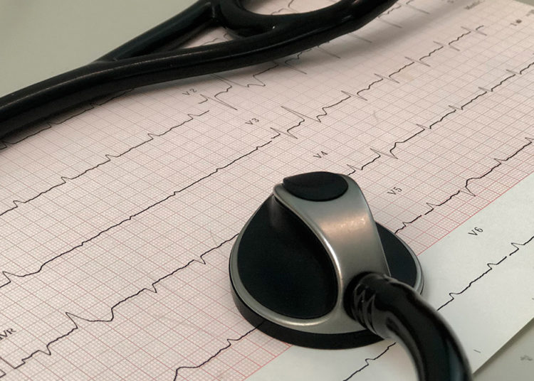 El electrocardiograma permite detectar cardiopatías/Pixabay