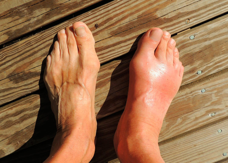 Tres ejercicios para mantener a punto los tobillos